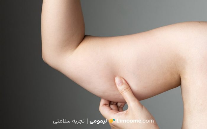 11 تا از بهترین روش‌ها برای لاغری بازو 