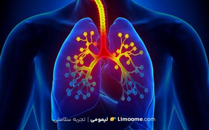 روش‌های موثر برای درمان آسم: راهکارهای مهم و قابل اعتماد
