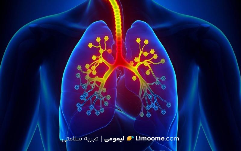 راه‌های درمان درمان آسم