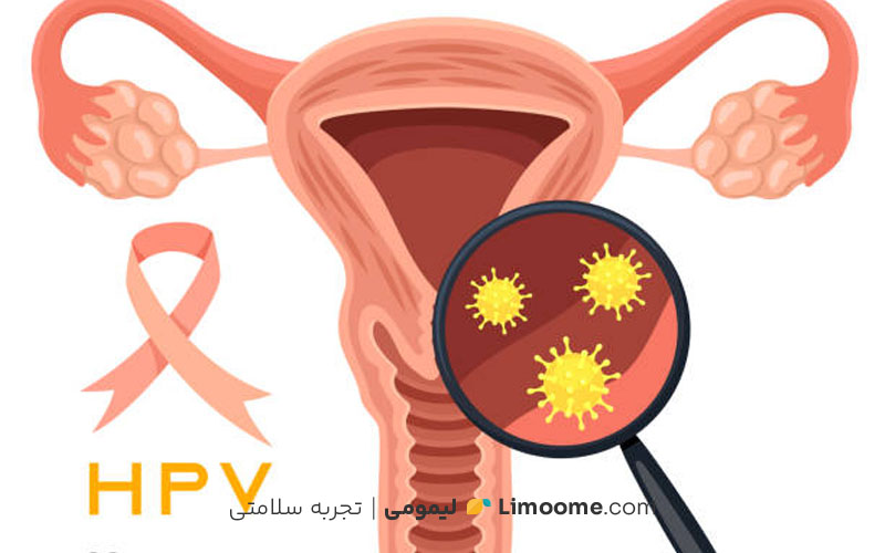 عفونت واژینال چیست