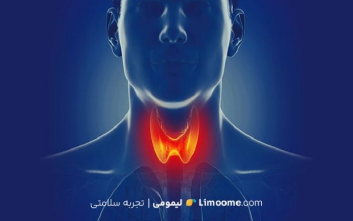 آشنایی با گریوز: از علائم تا روش‌های تشخیص و درمان مؤثر
