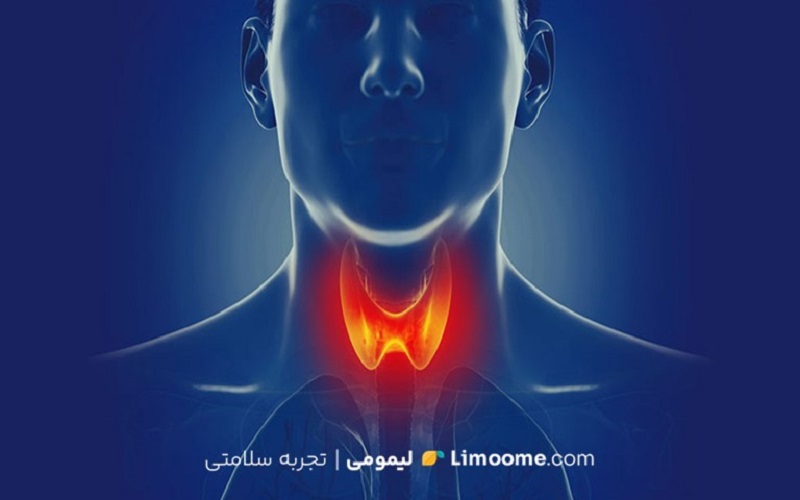 آشنایی با گریوز: از علائم تا روش‌های تشخیص و درمان مؤثر